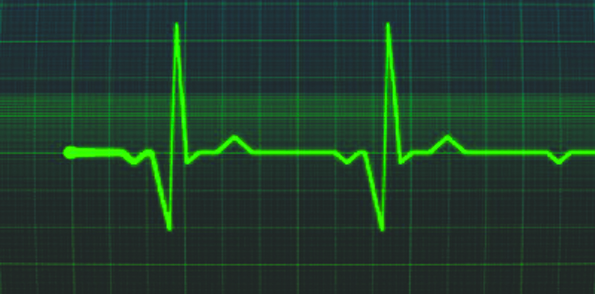 esteira com monitor cardiaco Esteira Batimentos Cardíacos